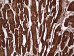 TNNT2 Antibody in Immunohistochemistry (Paraffin) (IHC (P))