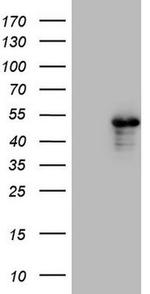 TNNT2 Antibody in Western Blot (WB)