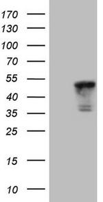 TNNT2 Antibody in Western Blot (WB)