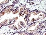 TOLLIP Antibody in Immunohistochemistry (Paraffin) (IHC (P))