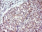 TOLLIP Antibody in Immunohistochemistry (Paraffin) (IHC (P))