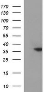 TOLLIP Antibody in Western Blot (WB)