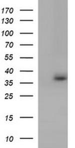 TOLLIP Antibody in Western Blot (WB)