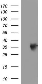 TOLLIP Antibody in Western Blot (WB)