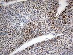 TOMM40 Antibody in Immunohistochemistry (Paraffin) (IHC (P))