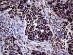 TOP1 Antibody in Immunohistochemistry (Paraffin) (IHC (P))