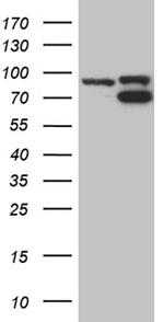 TOP1 Antibody in Western Blot (WB)