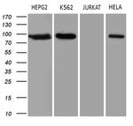 TOP1 Antibody in Western Blot (WB)