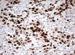 TOP2A Antibody in Immunohistochemistry (Paraffin) (IHC (P))