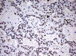 TOP2A Antibody in Immunohistochemistry (Paraffin) (IHC (P))