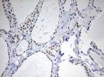 TOP2A Antibody in Immunohistochemistry (Paraffin) (IHC (P))