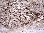 TOP2A Antibody in Immunohistochemistry (Paraffin) (IHC (P))