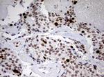 TOP2A Antibody in Immunohistochemistry (Paraffin) (IHC (P))