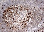 TOP2A Antibody in Immunohistochemistry (Paraffin) (IHC (P))