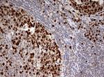 TOP2A Antibody in Immunohistochemistry (Paraffin) (IHC (P))