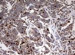 TOP2A Antibody in Immunohistochemistry (Paraffin) (IHC (P))