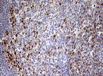 TOP2A Antibody in Immunohistochemistry (Paraffin) (IHC (P))