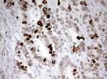 TOP2A Antibody in Immunohistochemistry (Paraffin) (IHC (P))