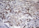 TOP2A Antibody in Immunohistochemistry (Paraffin) (IHC (P))