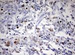 TOP2A Antibody in Immunohistochemistry (Paraffin) (IHC (P))