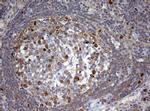 TOP2A Antibody in Immunohistochemistry (Paraffin) (IHC (P))