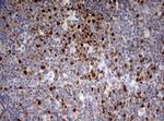 TOP2A Antibody in Immunohistochemistry (Paraffin) (IHC (P))