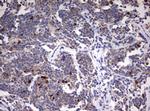 TOP2A Antibody in Immunohistochemistry (Paraffin) (IHC (P))