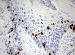 TOP2A Antibody in Immunohistochemistry (Paraffin) (IHC (P))