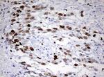 TOP2A Antibody in Immunohistochemistry (Paraffin) (IHC (P))