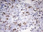 TOP2A Antibody in Immunohistochemistry (Paraffin) (IHC (P))