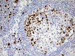 TOP2A Antibody in Immunohistochemistry (Paraffin) (IHC (P))