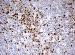 TOP2A Antibody in Immunohistochemistry (Paraffin) (IHC (P))