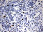 TOP2A Antibody in Immunohistochemistry (Paraffin) (IHC (P))