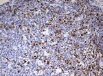 TOP2A Antibody in Immunohistochemistry (Paraffin) (IHC (P))