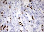 TOP2A Antibody in Immunohistochemistry (Paraffin) (IHC (P))