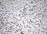 TOP2A Antibody in Immunohistochemistry (Paraffin) (IHC (P))