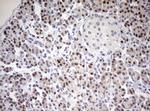 TOP2A Antibody in Immunohistochemistry (Paraffin) (IHC (P))