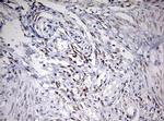 TOP2A Antibody in Immunohistochemistry (Paraffin) (IHC (P))