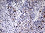 TOP2A Antibody in Immunohistochemistry (Paraffin) (IHC (P))