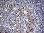 TOP2A Antibody in Immunohistochemistry (Paraffin) (IHC (P))