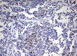 TOP2A Antibody in Immunohistochemistry (Paraffin) (IHC (P))