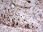 TOP2A Antibody in Immunohistochemistry (Paraffin) (IHC (P))