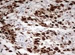 TOP2A Antibody in Immunohistochemistry (Paraffin) (IHC (P))