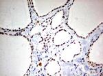 TOP2A Antibody in Immunohistochemistry (Paraffin) (IHC (P))