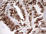 TOP2A Antibody in Immunohistochemistry (Paraffin) (IHC (P))