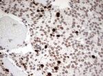 TOP2A Antibody in Immunohistochemistry (Paraffin) (IHC (P))