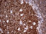 TOP2A Antibody in Immunohistochemistry (Paraffin) (IHC (P))