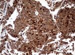 TOP2A Antibody in Immunohistochemistry (Paraffin) (IHC (P))