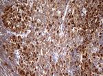 TOP2A Antibody in Immunohistochemistry (Paraffin) (IHC (P))