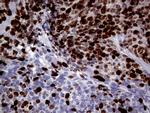 TOP2A Antibody in Immunohistochemistry (Paraffin) (IHC (P))